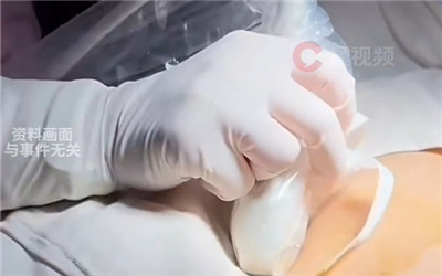 从表兄妹结婚后胎儿患罕见遗传病