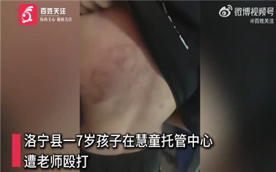打伤7岁孩子的托管老师已被拘