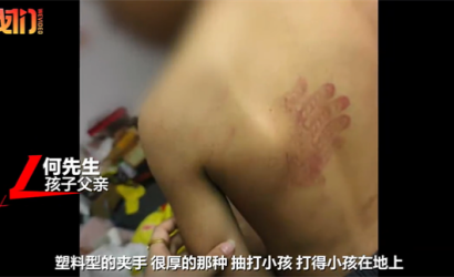 当地警方就男童被故意伤害一事立案调查