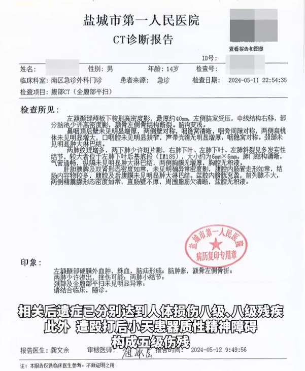 13岁男生被同学殴打到瞳孔散